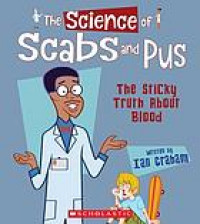 The science of scabs and pus : the sticky truth about blood